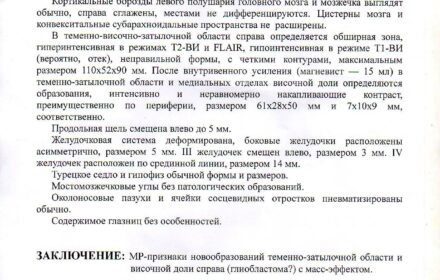 Сбор средств на операцию по удалению опухоли мозга