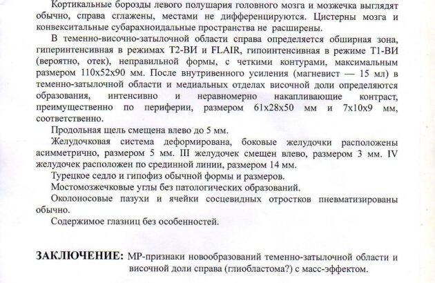 Сбор средств на операцию по удалению опухоли мозга